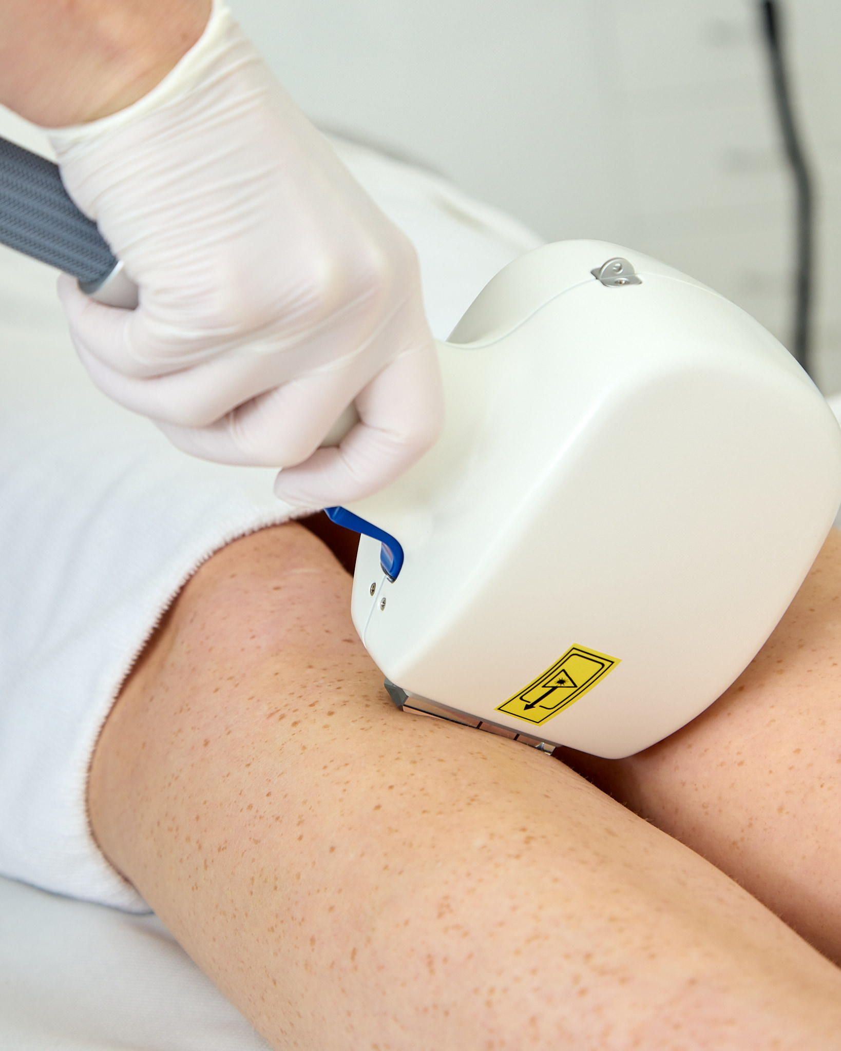 A gloved practitioner uses a professional handheld laser device for a skin treatment on a patient’s leg.