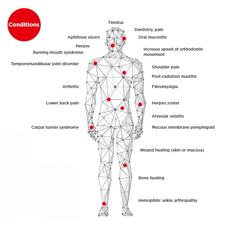 A diagram of a human figure highlighting various medical conditions treatable with laser therapy.