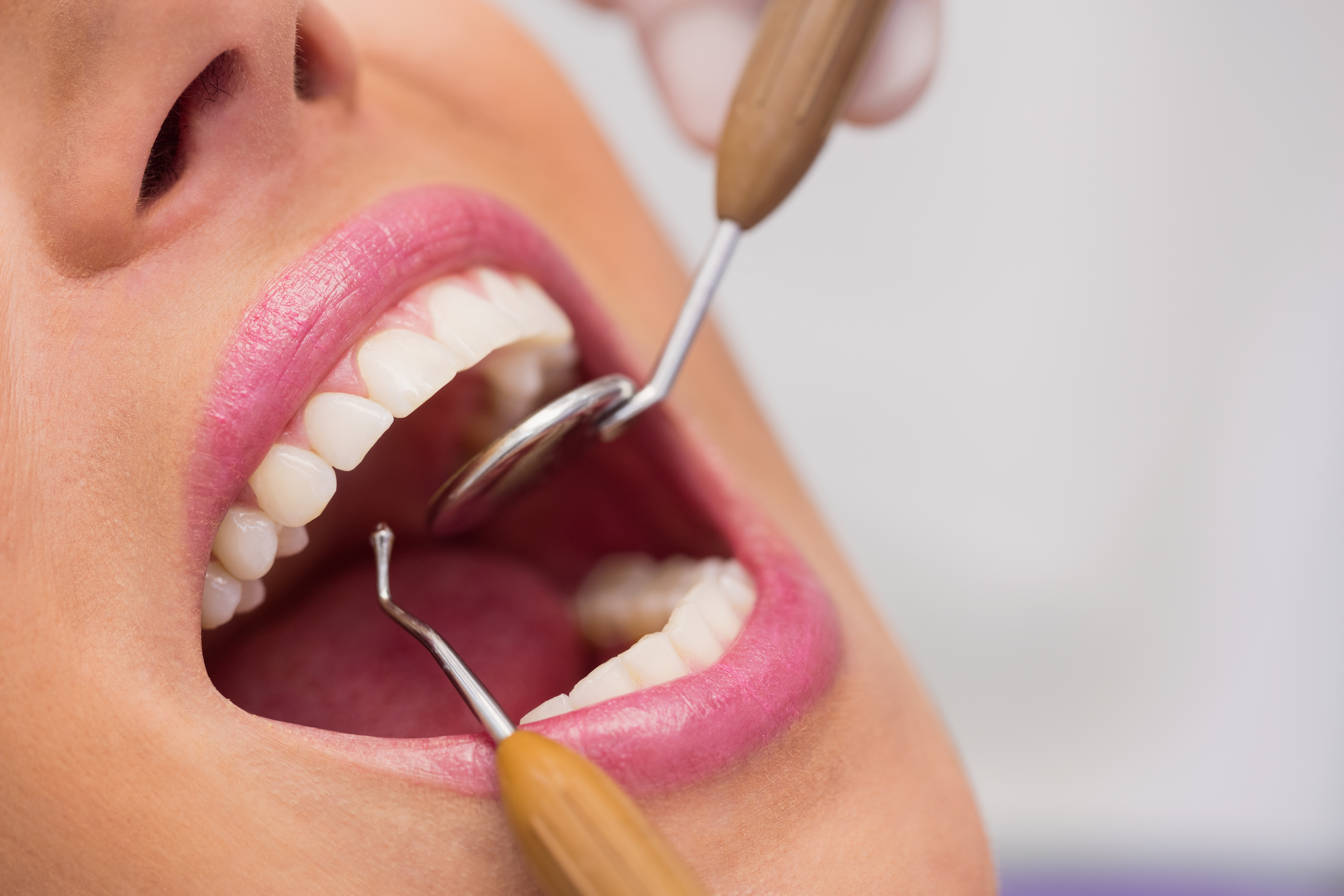 Close-up of dental examination with mirror and probe tool inspecting patient teeth and gums during routine checkup