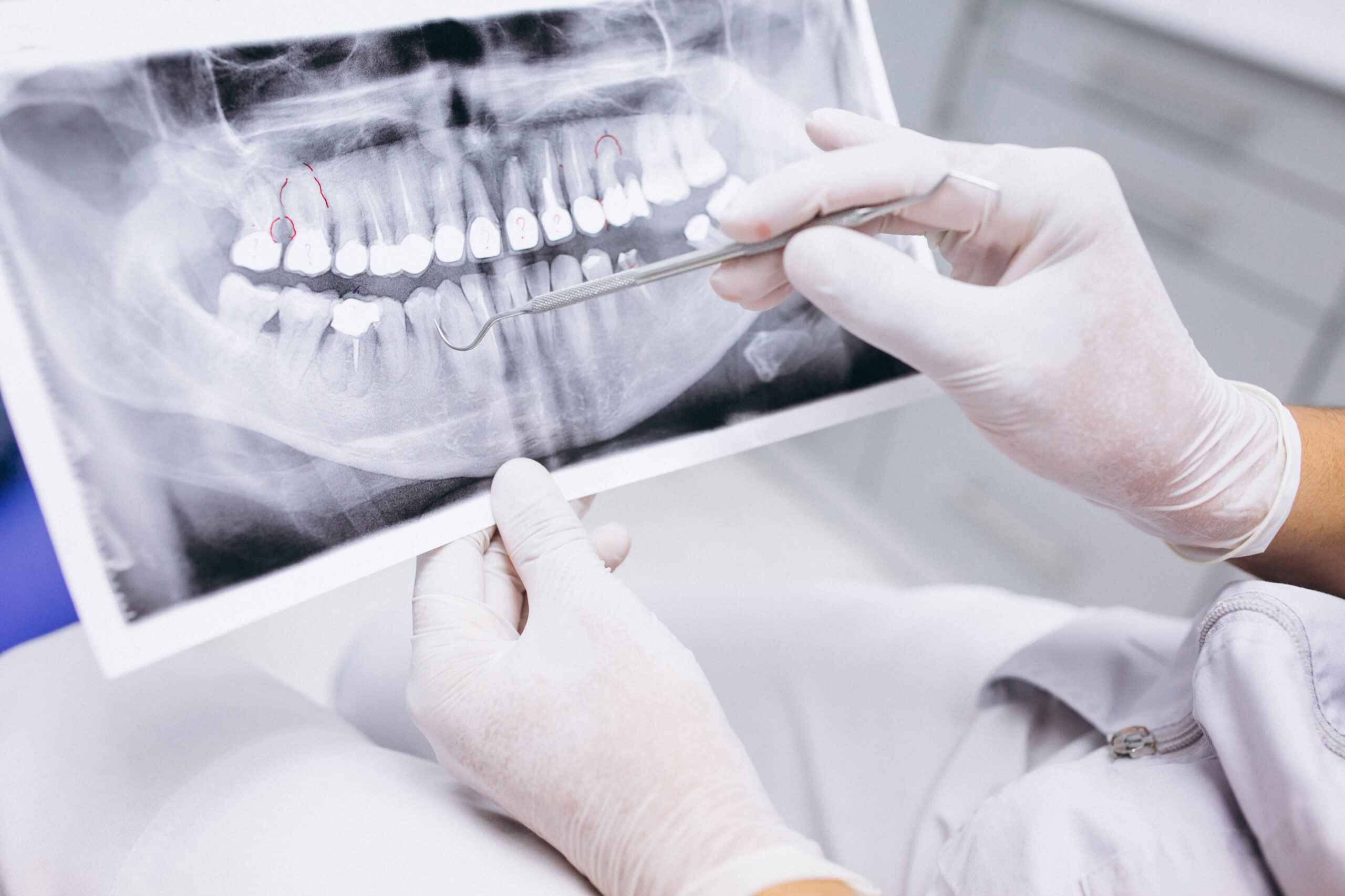 Dentist analyzing panoramic dental X-ray and pointing at teeth with dental probe to assess oral health condition
