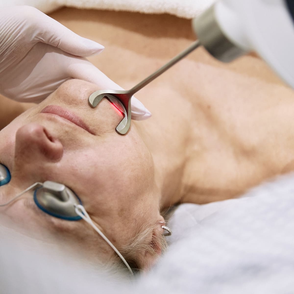 Expore our range – Aesthetics Lasers Patient receiving non-invasive laser skin treatment on upper lip in medical aesthetic clinic setting