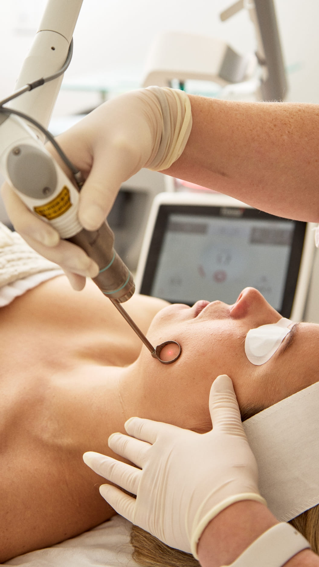 _High-Performance Aesthetic Systems for Modern Practices A specialist in protective eyewear uses a professional laser system for a patient's facial treatment.
